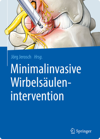 Minimalinvasive Wirbelsäulenintervention