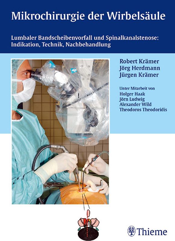 Mikrochirurgie der Wirbelsäule