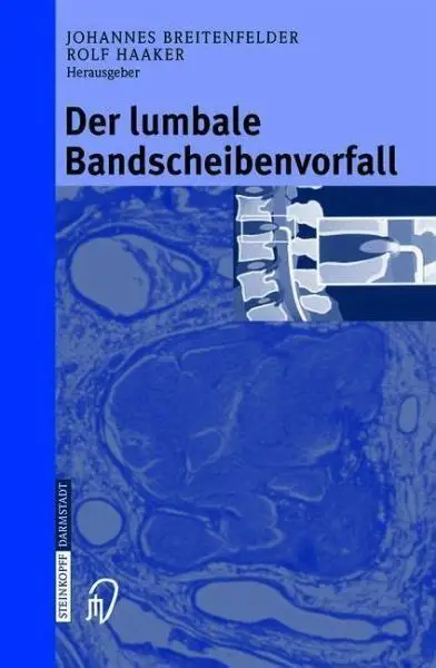 Der lumbale Bandscheibenvorfall
