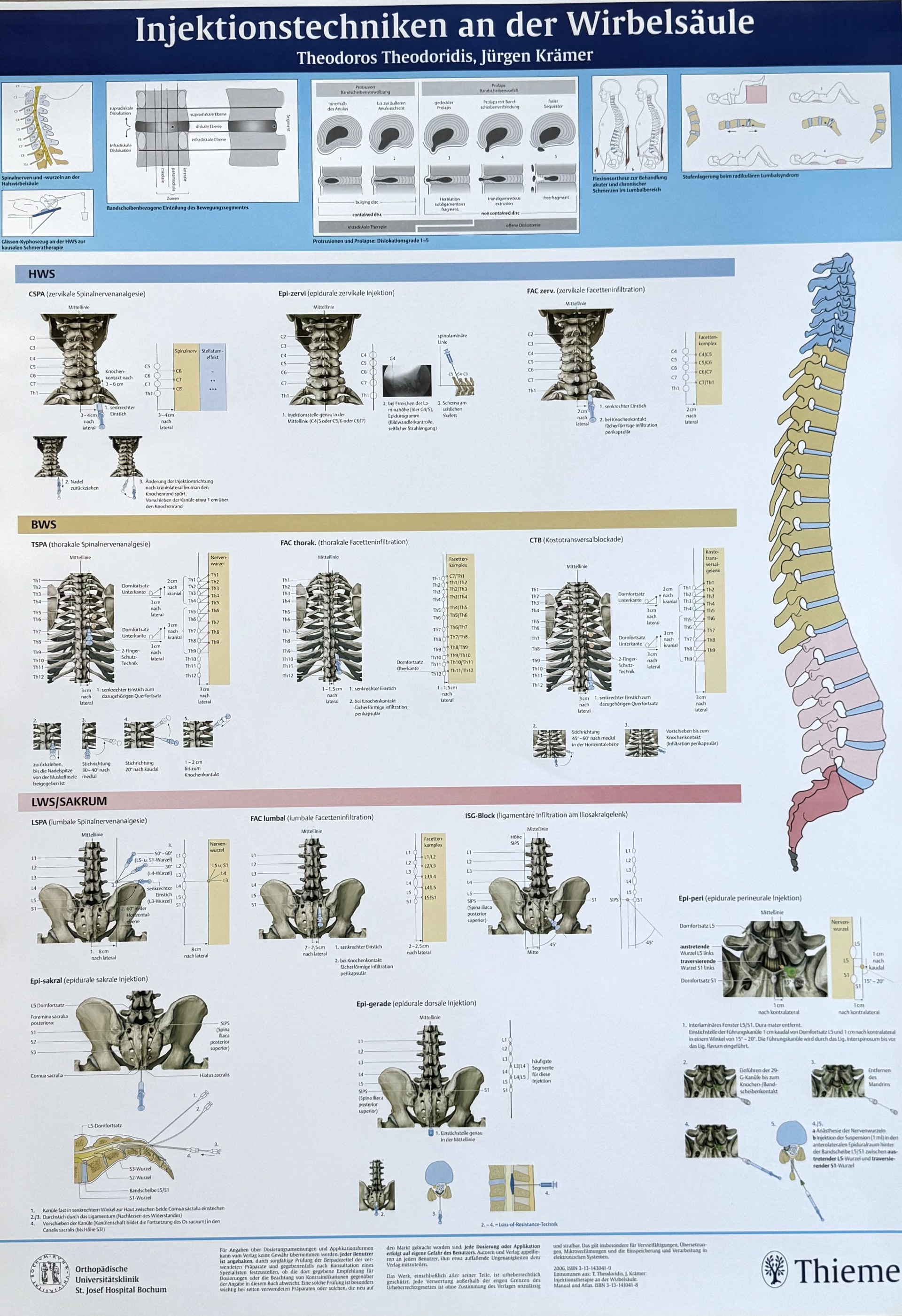 Injektionstherapie an der Wirbelsäule - das Arbeitsposter für die Sprechstunde